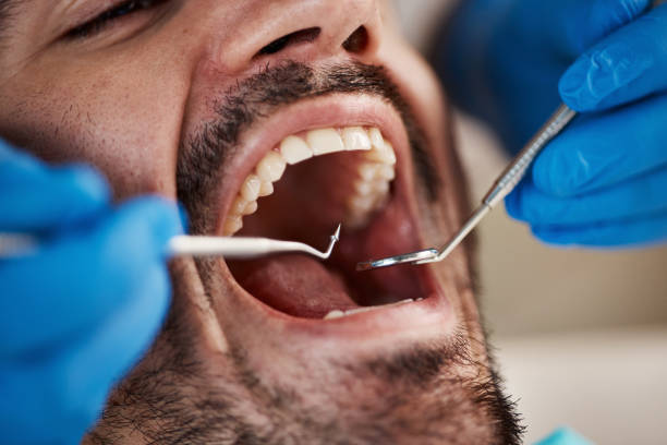 Emergency Dentist Open Today in AL